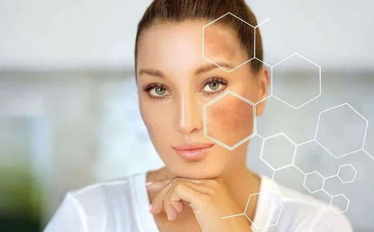 ✨ احصلي على بشرة أفتح وأكثر إشراقًا مع منتجات تفتيح البشرة من Pinky Cosmetics 💖